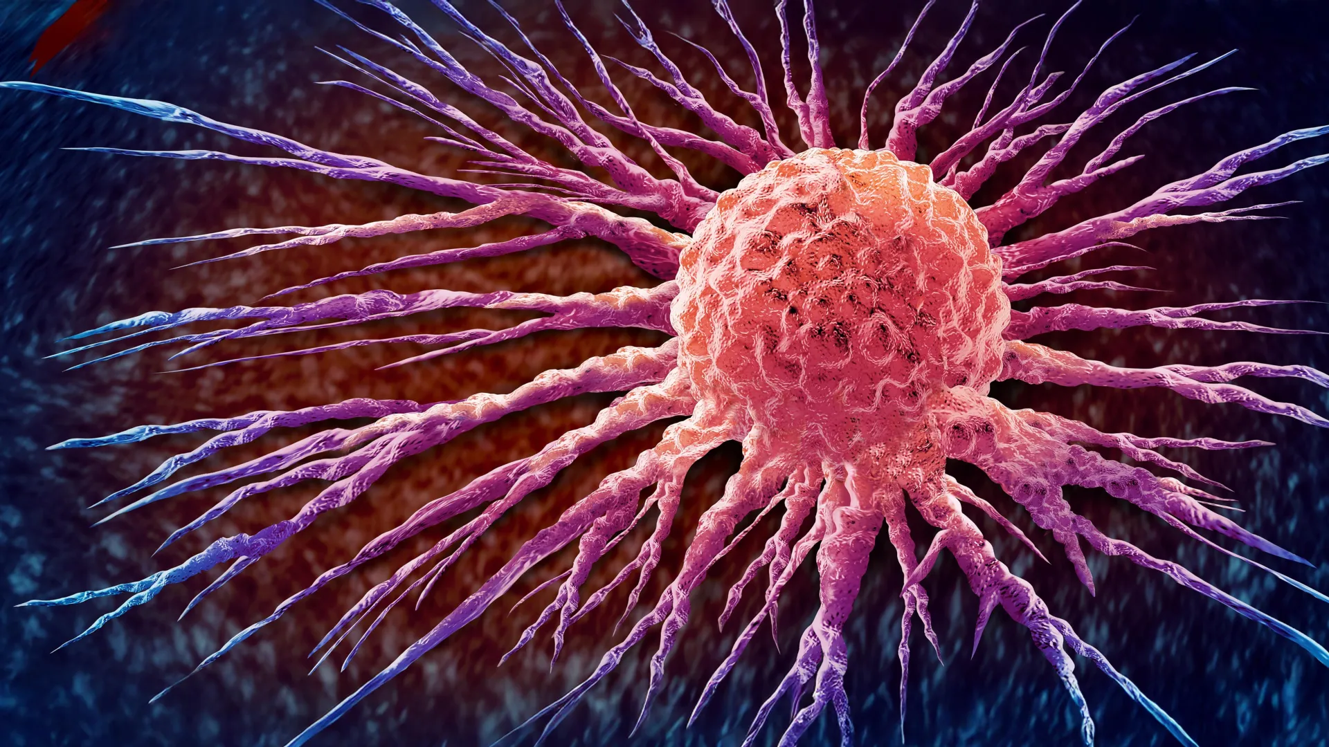 Global Cancer Incidence on the Rise, Underscoring Urgent Need for Preparedness