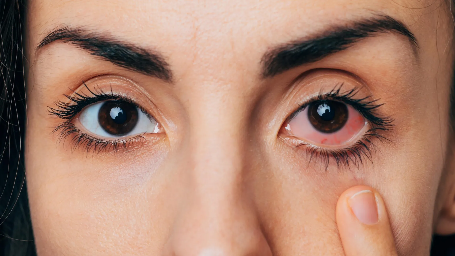 Half of adults suffer from dry eyes, but most never get help