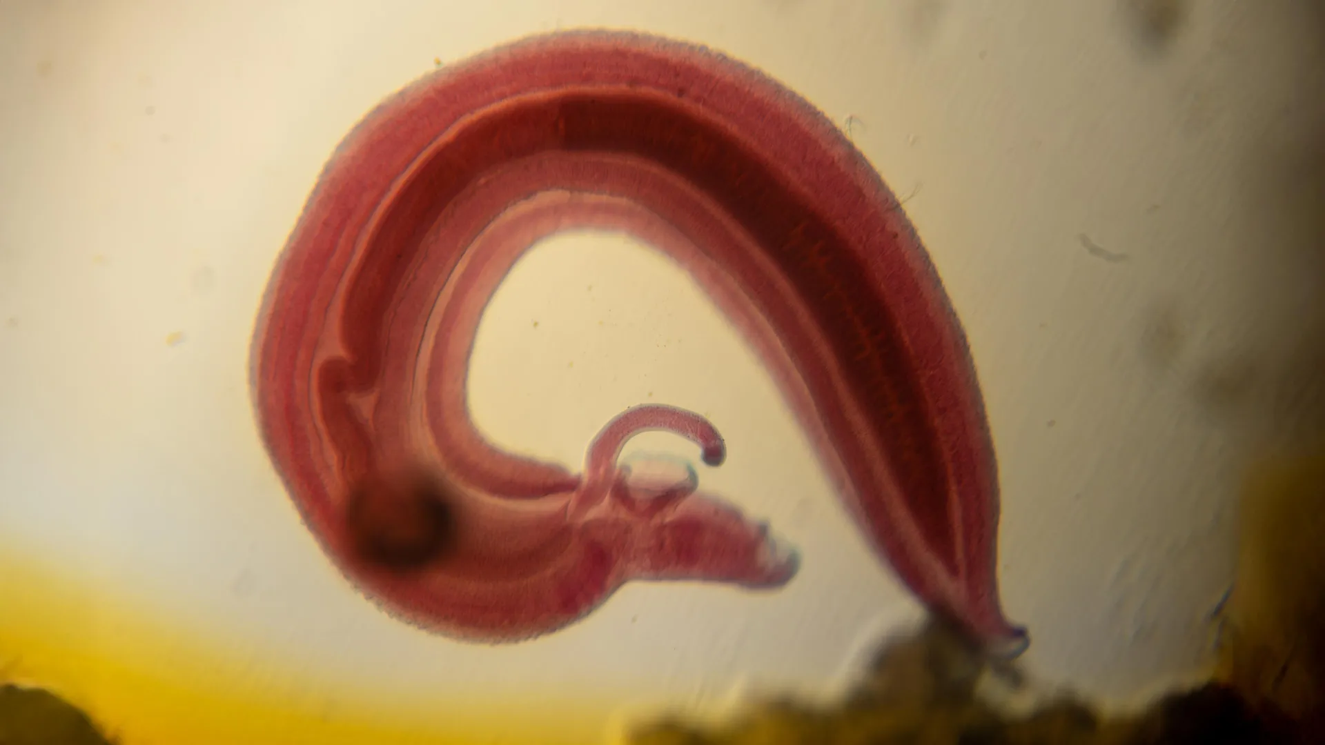 A Parasitic Infection that Disrupts Pain Perception